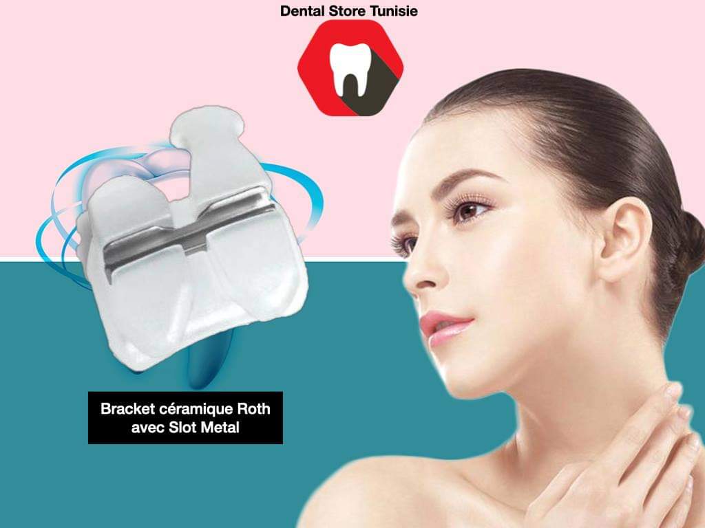 ceramic bracket with metal slot